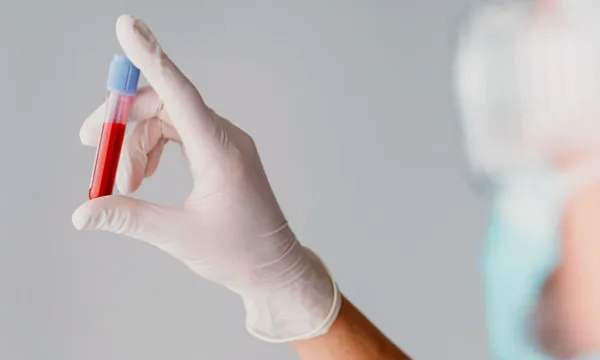 muestra-sangre-examenfreepik.jpg