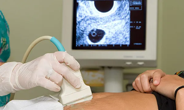 ecografia-examenmedico-salud1shut-1509242163.jpg