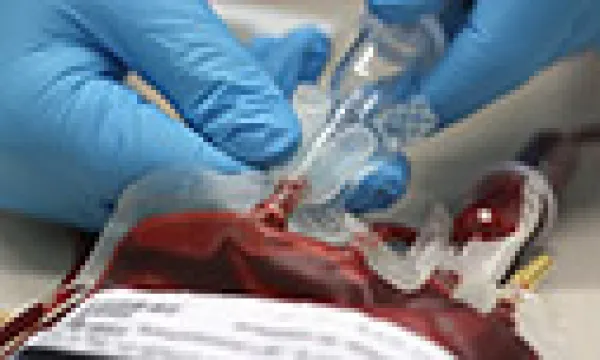medi153001sangre2-1509242891.jpg