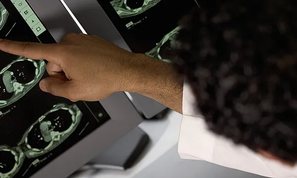 radiografia-salud-medico2think-1509241918.jpg