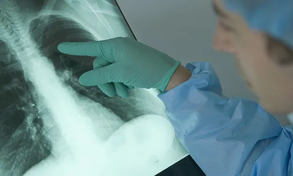 radiografia-salud-medicothink-1509242192.jpg
