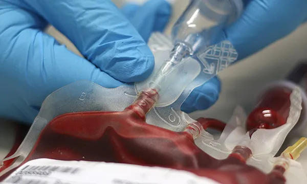 salud-sangre-transfusionshut-1509241752.jpg