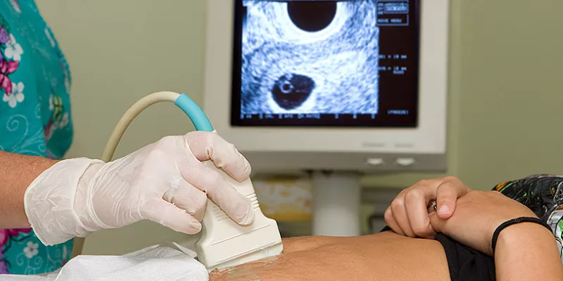 ecografia-examenmedico-salud1shut-1509241999.jpg