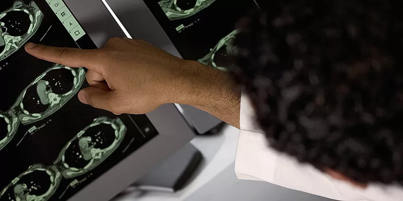 radiografia-salud-medico2think-1509242120.jpg